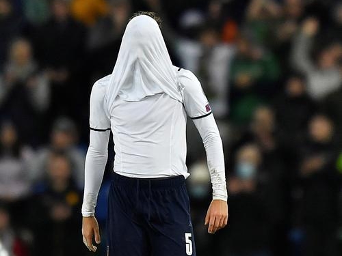 ��ŷ��Ԥ��������Ӳ�C�޺󳾣�������ŷ�ޱ��ھ����򸽼���